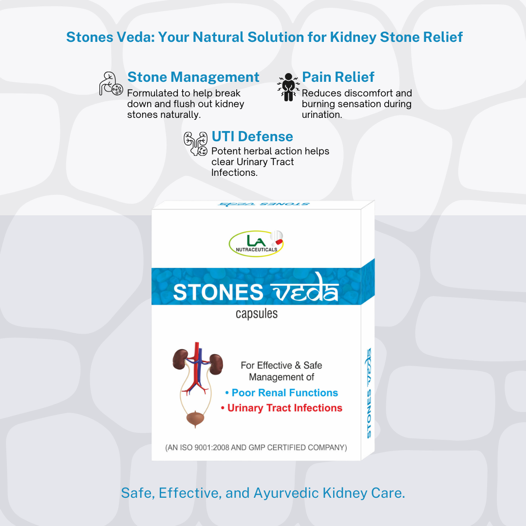 Stones Veda Capsules for Relief from Kidney Stones | 30 Capsules