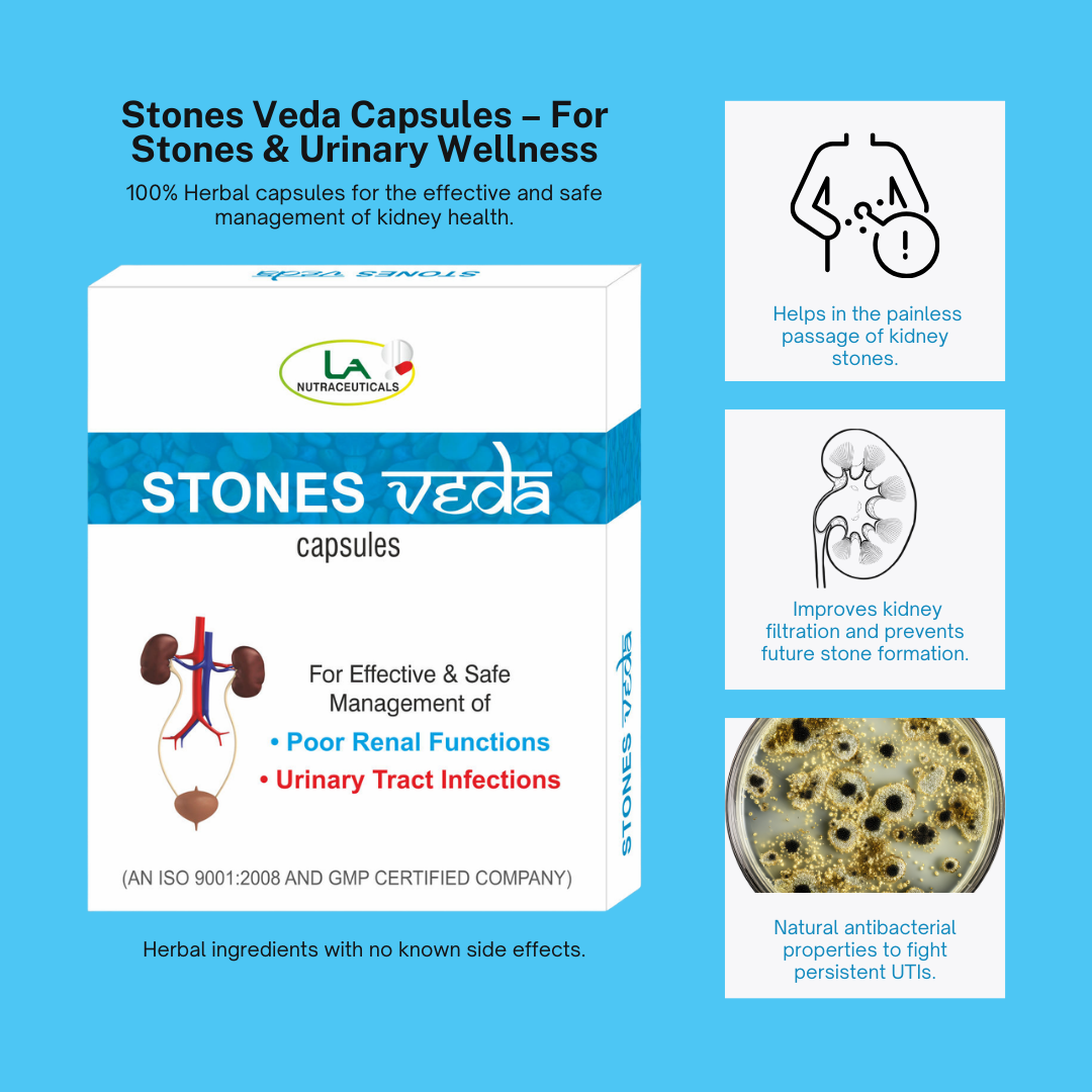 Stones Veda Capsules for Relief from Kidney Stones | 30 Capsules